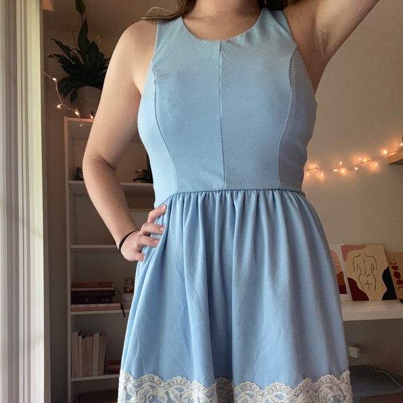 Tank Dress With Lace Detail - Picture 6 of 8